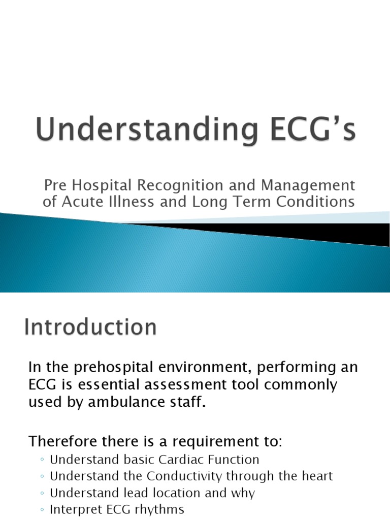 Understanding Ecg A Comprehensive Guide To Electrocardiography Sci Chores Understanding Ecg A Comprehensive Guide To Electrocardiography Sci Chores